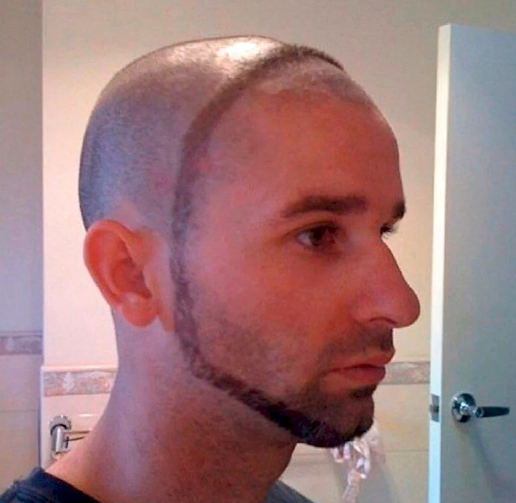 Фейд налысо