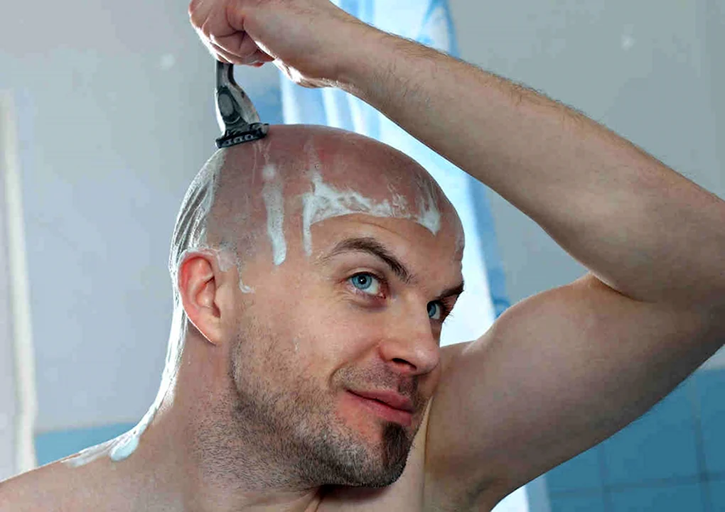 Налысо Лебедев