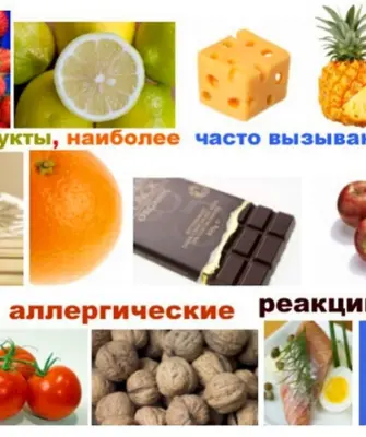 Продукты вызывающие аллергию